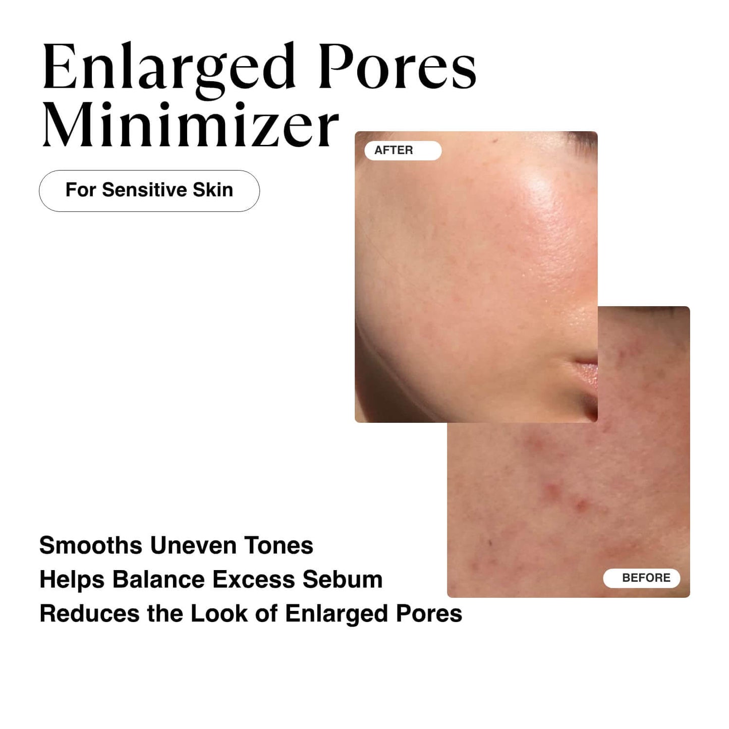Niacinamide Glow Serum: Anti-Aging & Pore Reducing Formula with Vitamin E