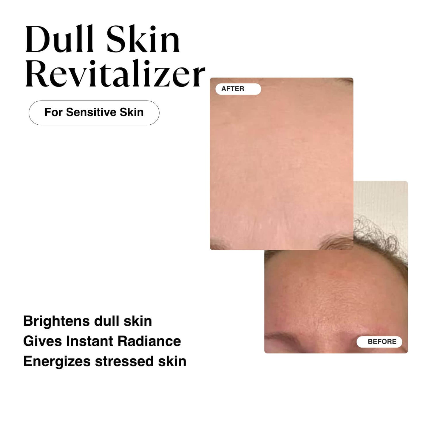 Niacinamide Glow Serum: Anti-Aging & Pore Reducing Formula with Vitamin E