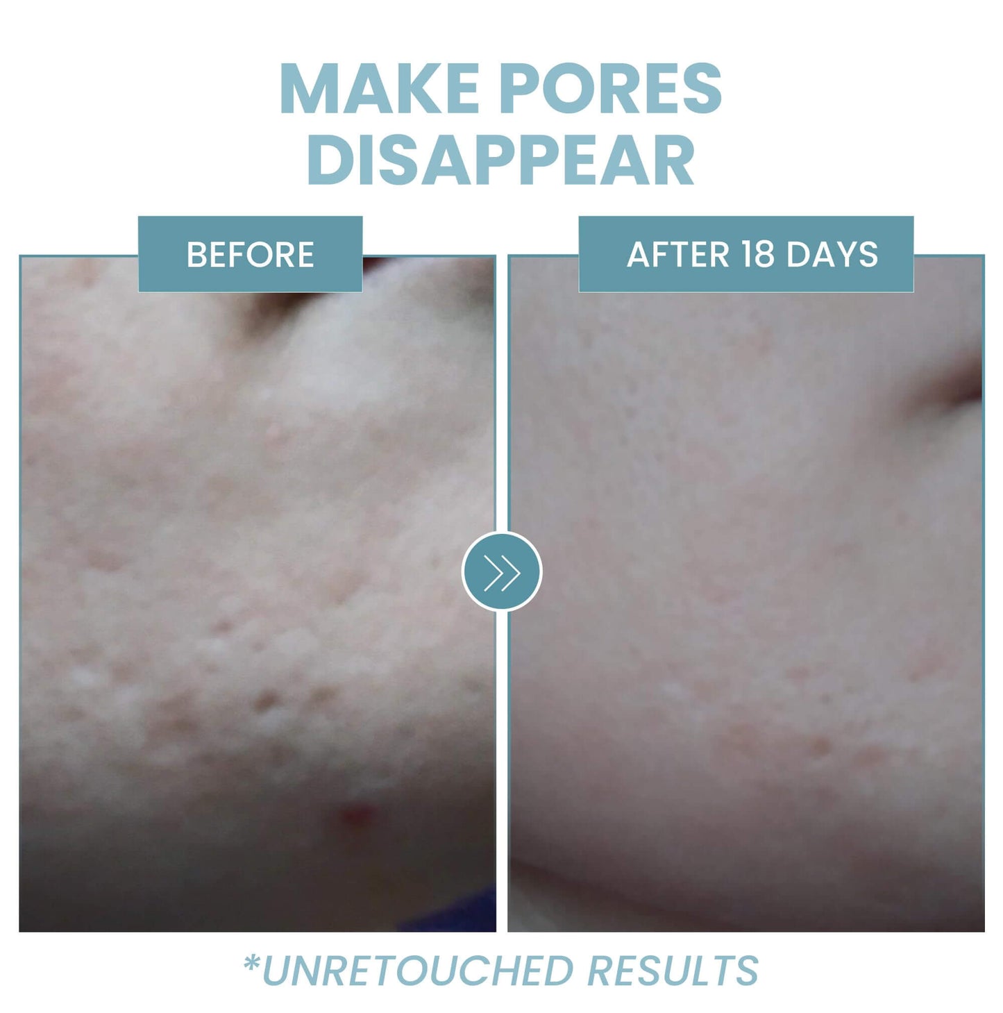 Skin Revival Niacinamide & Hyaluronic Acid Serum - 60ml