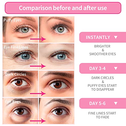 BREYLEE Rose Eye Mask Under Eye Patches - 60 Pcs | GreenLifeHuman Emporium