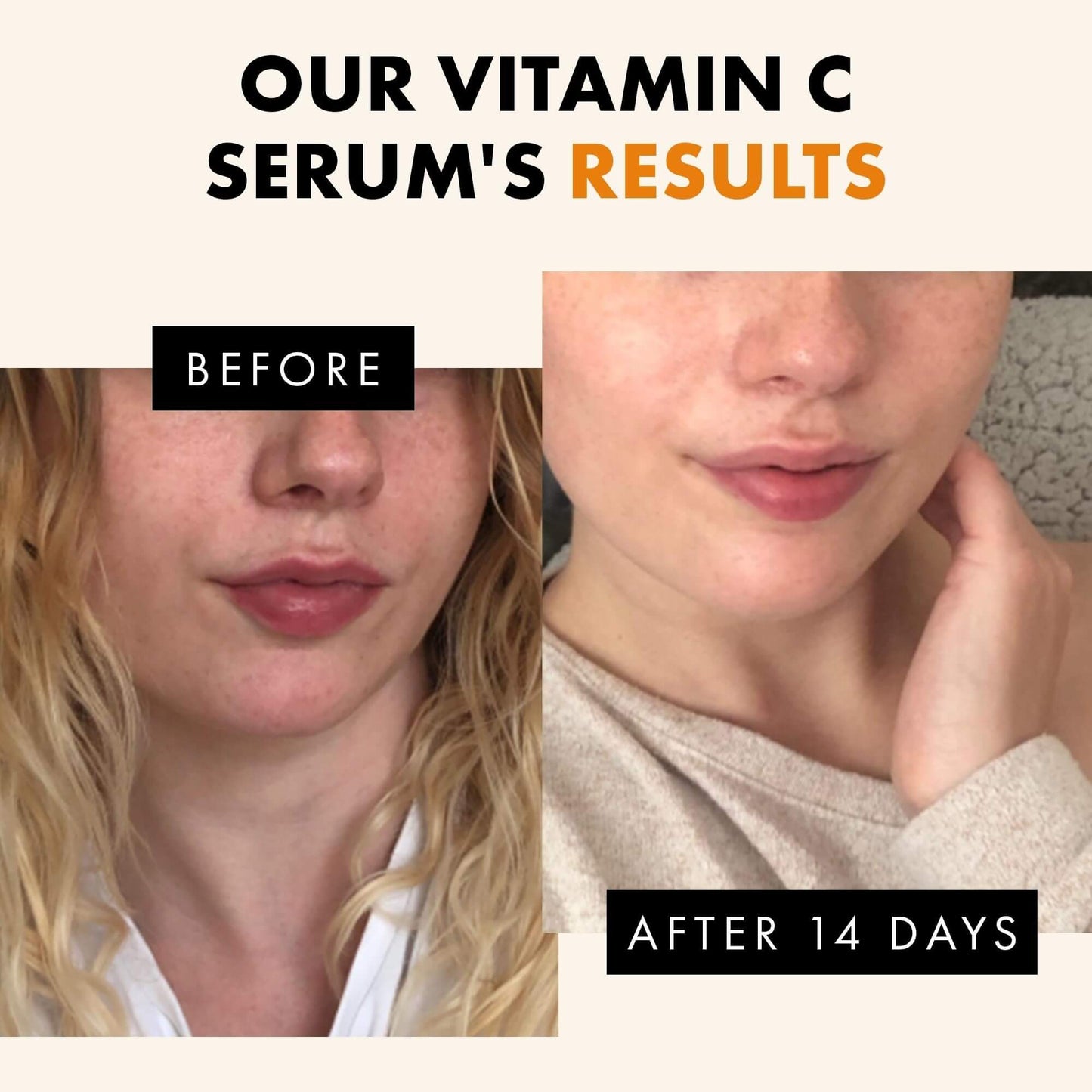 Skin Revival: Vitamin C Serum with Hyaluronic Acid 30 ml