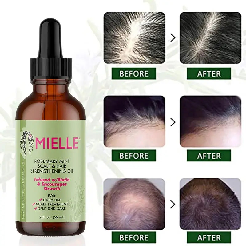 Mielle Organic Hair Growth Essential Oil with Rosemary & Mint - Strengthening & Nourishing Treatment for Split Ends & Dry Hair | GreenLifeHuman Emporium